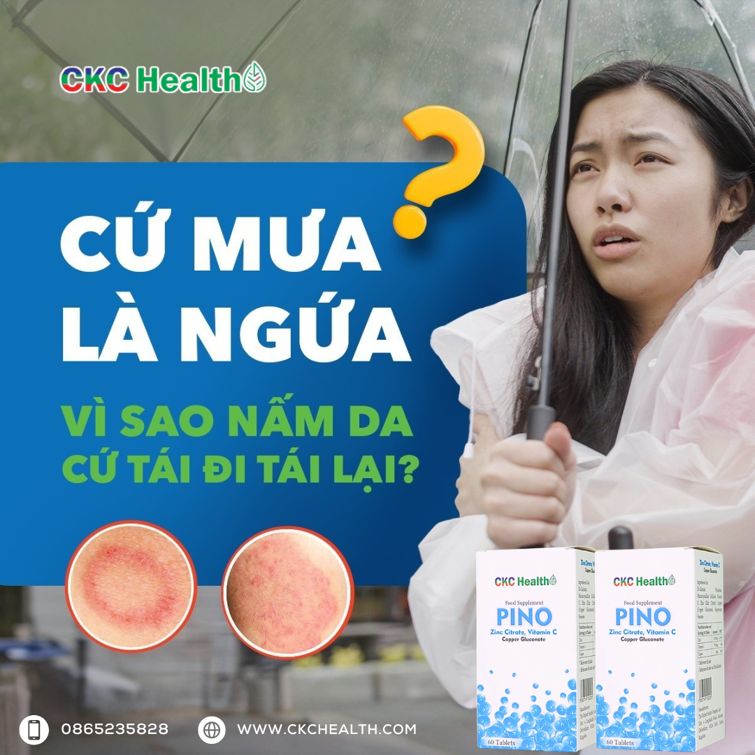 NGỨA DA NGÀY MƯA – CẢNH BÁO NẤM DA TÁI PHÁT ĐỪNG CHỦ QUAN!